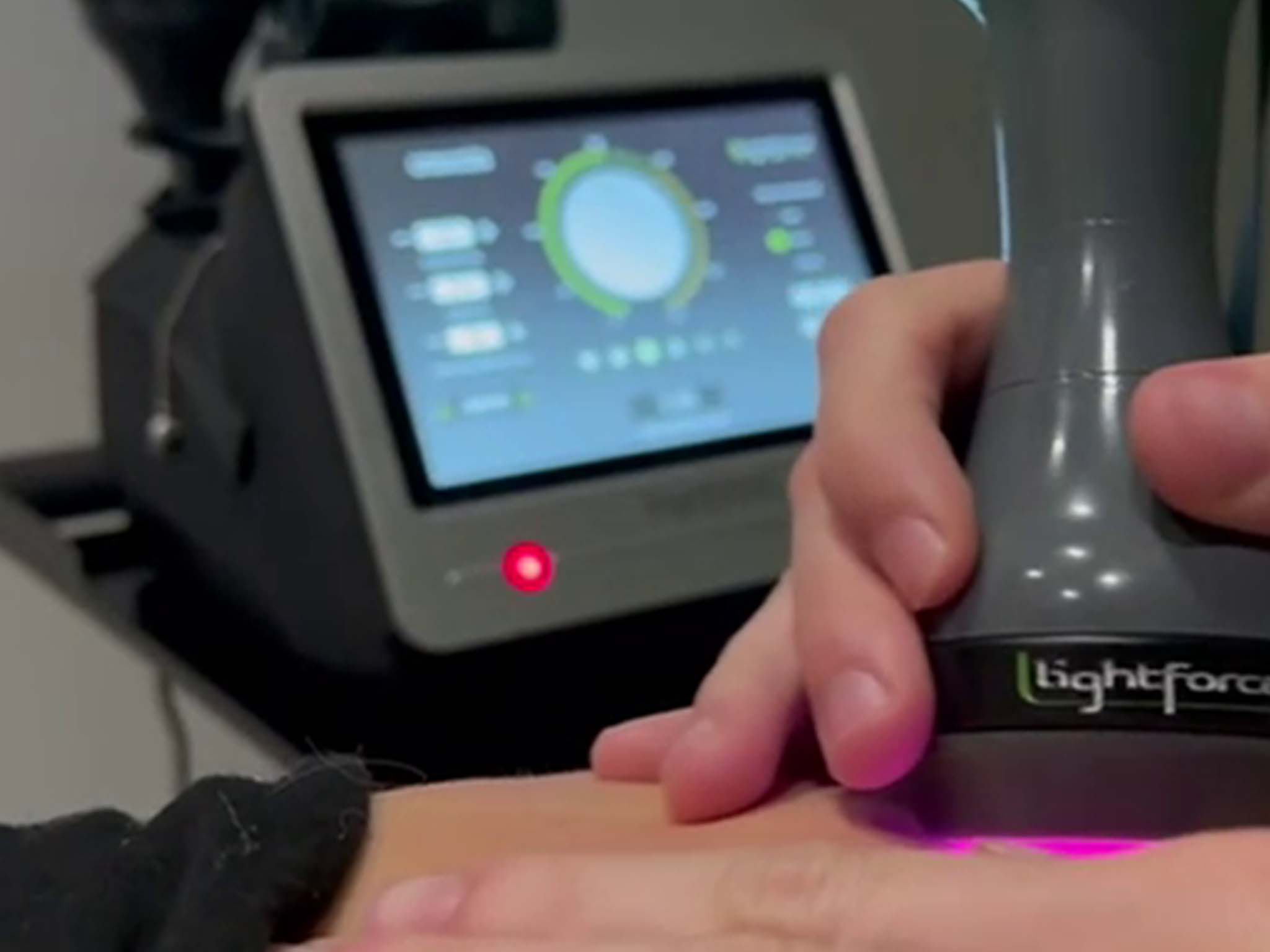 clinica de fisioterapia fisiomuro en almeria laser de alta potencia