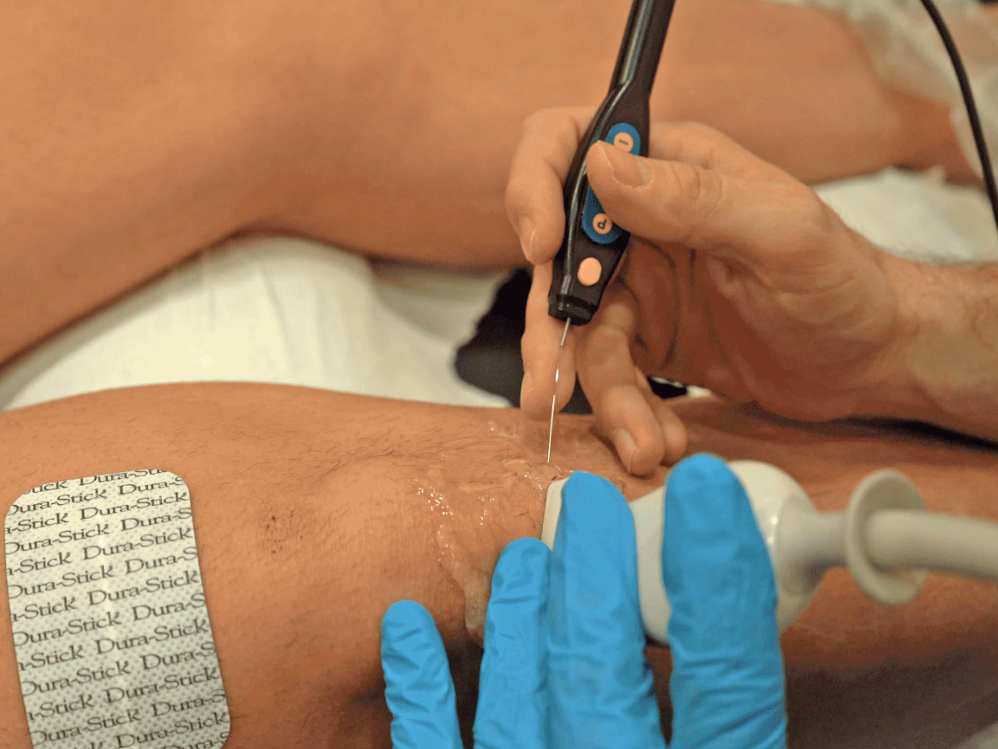 clinica de fisioterapia fisiomuro en almeria neuromodulacion