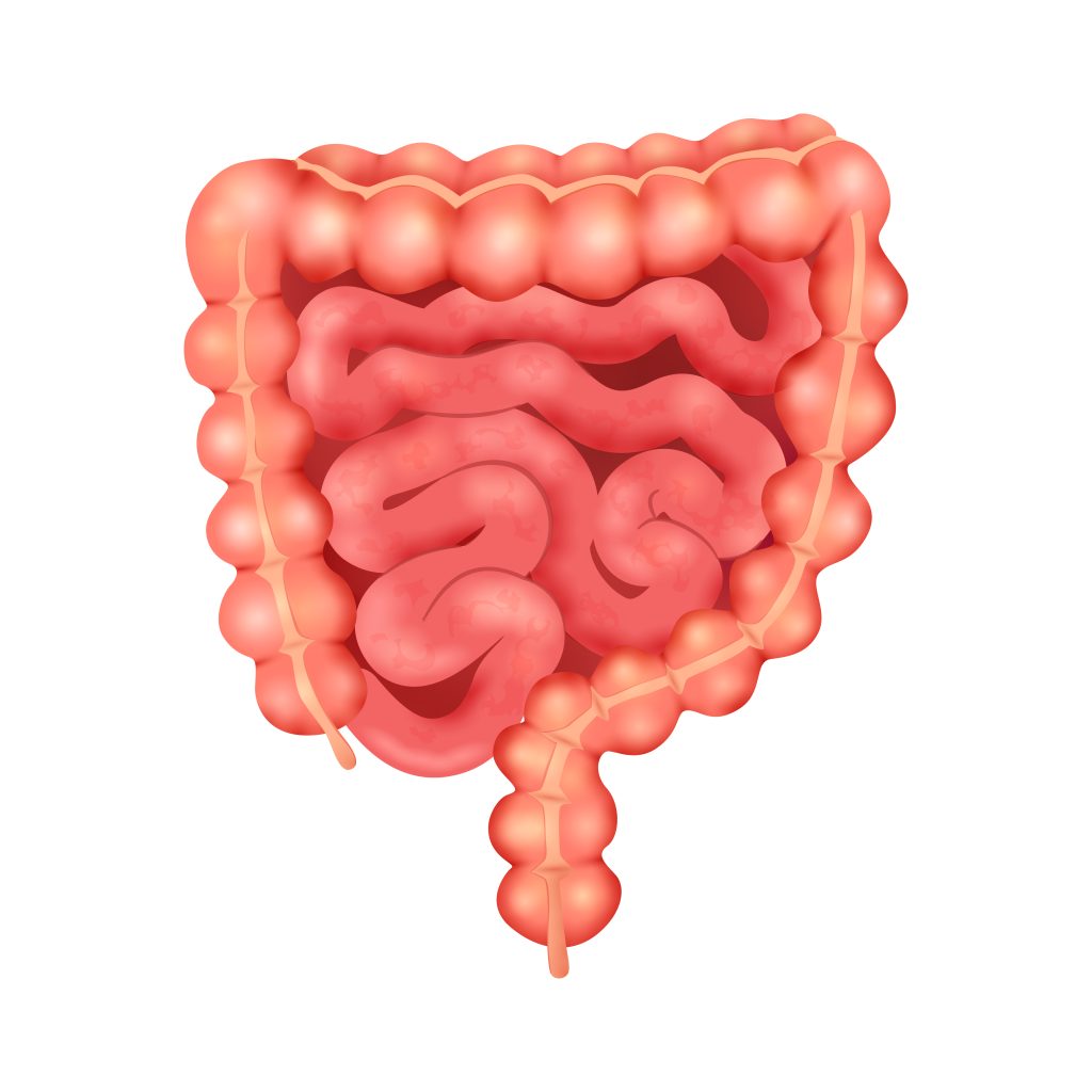 Colon irritable
