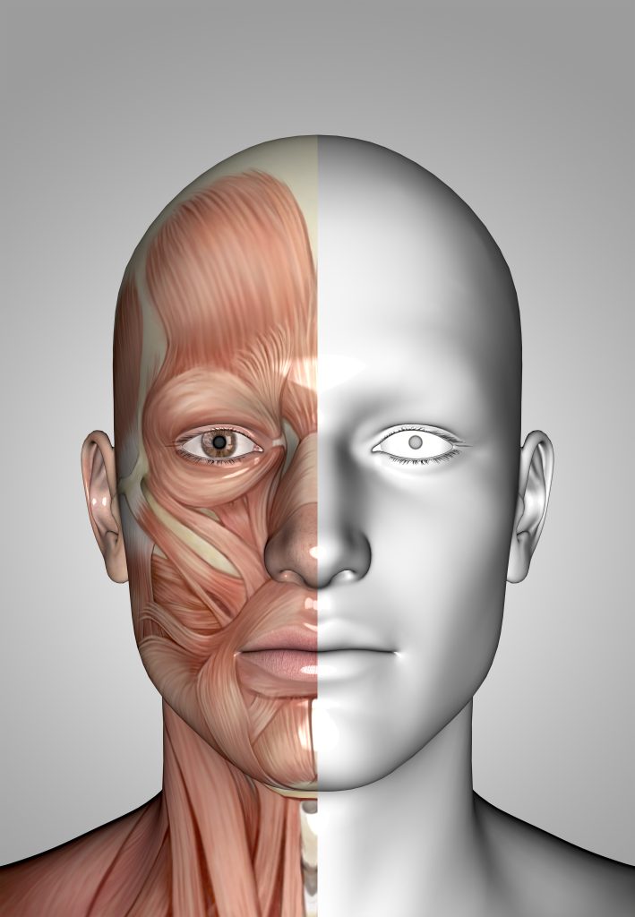 Parálisis facial