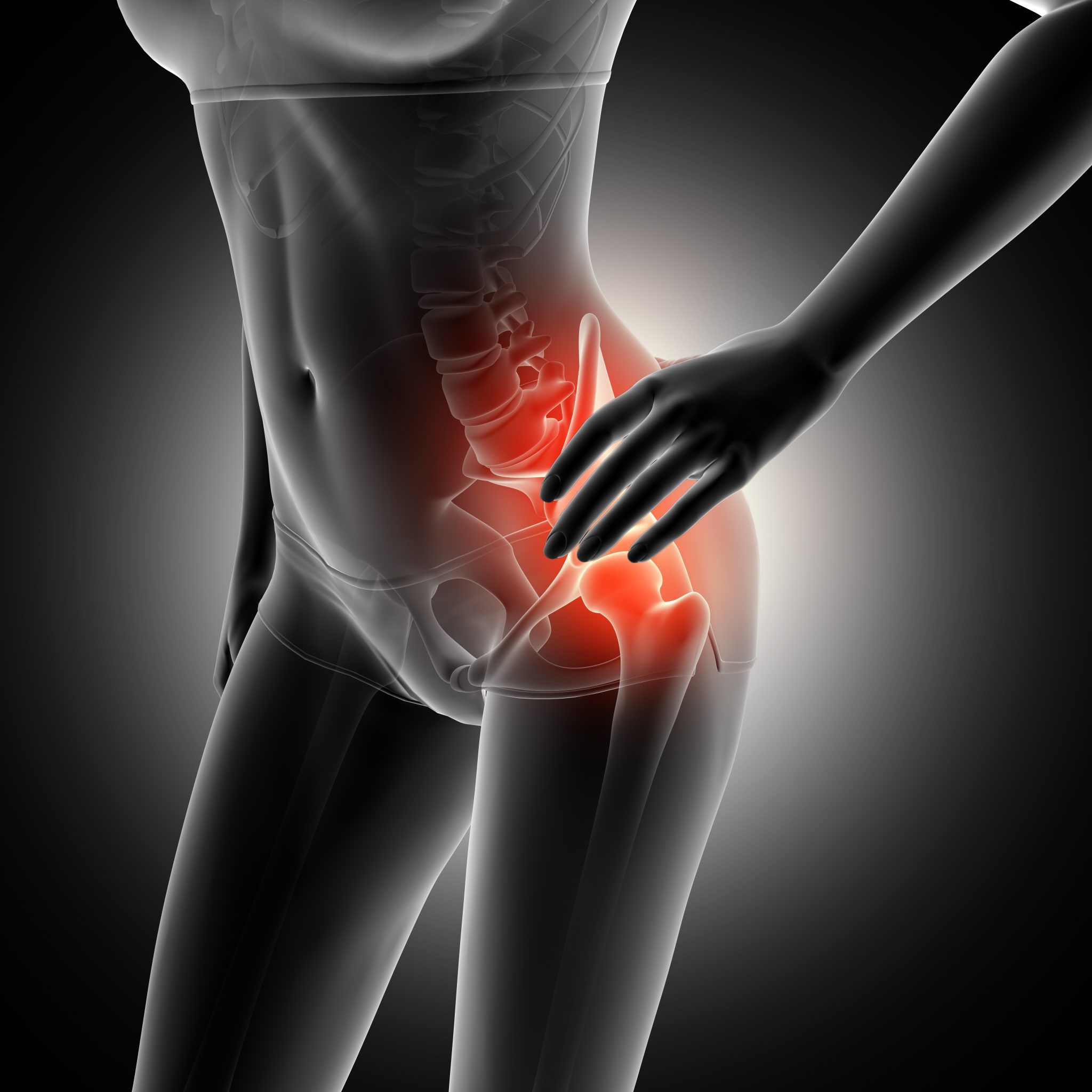 PUBALGIA